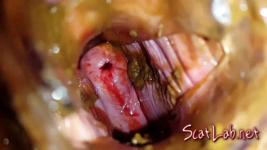 Shit and Blood Vol.5 Speculum Full version (Anna Coprofield) Slander, Bull, Solo [FullHD 1080p] Poop Videos