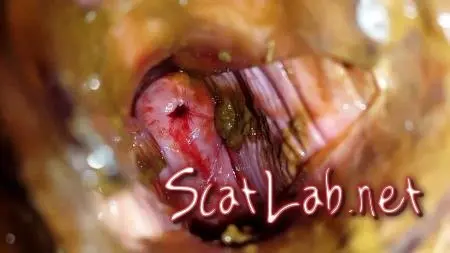 Shit and Blood Vol.5 Speculum Full version (Anna Coprofield) Slander, Bull, Solo [FullHD 1080p] Poop Videos