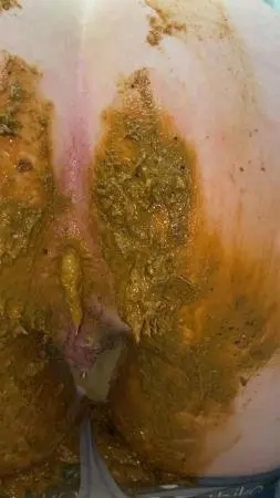 Extreme jean accident (Sexandcandy18) Scatology, Solo [UltraHD 2K] Jean Pooping ScatLab.net