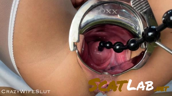 Scatbook.com - Cervix And Peehole [FullHD 1080p] 637 MB